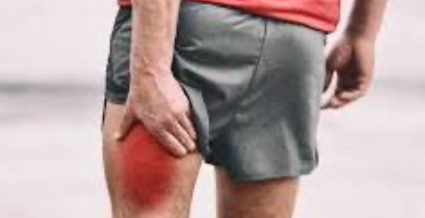 Pulled hamstrings ouch! 🔥