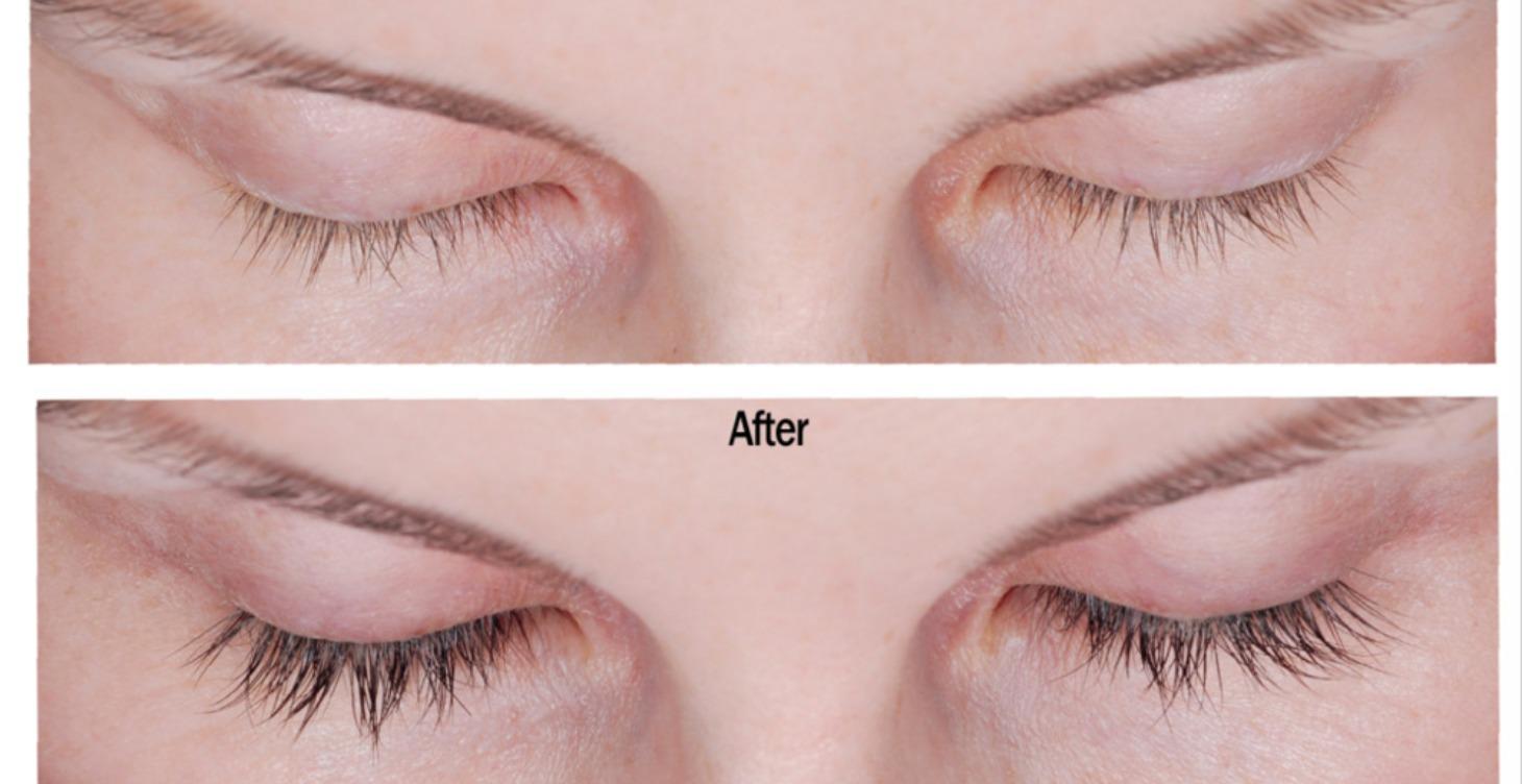 Eyelashes