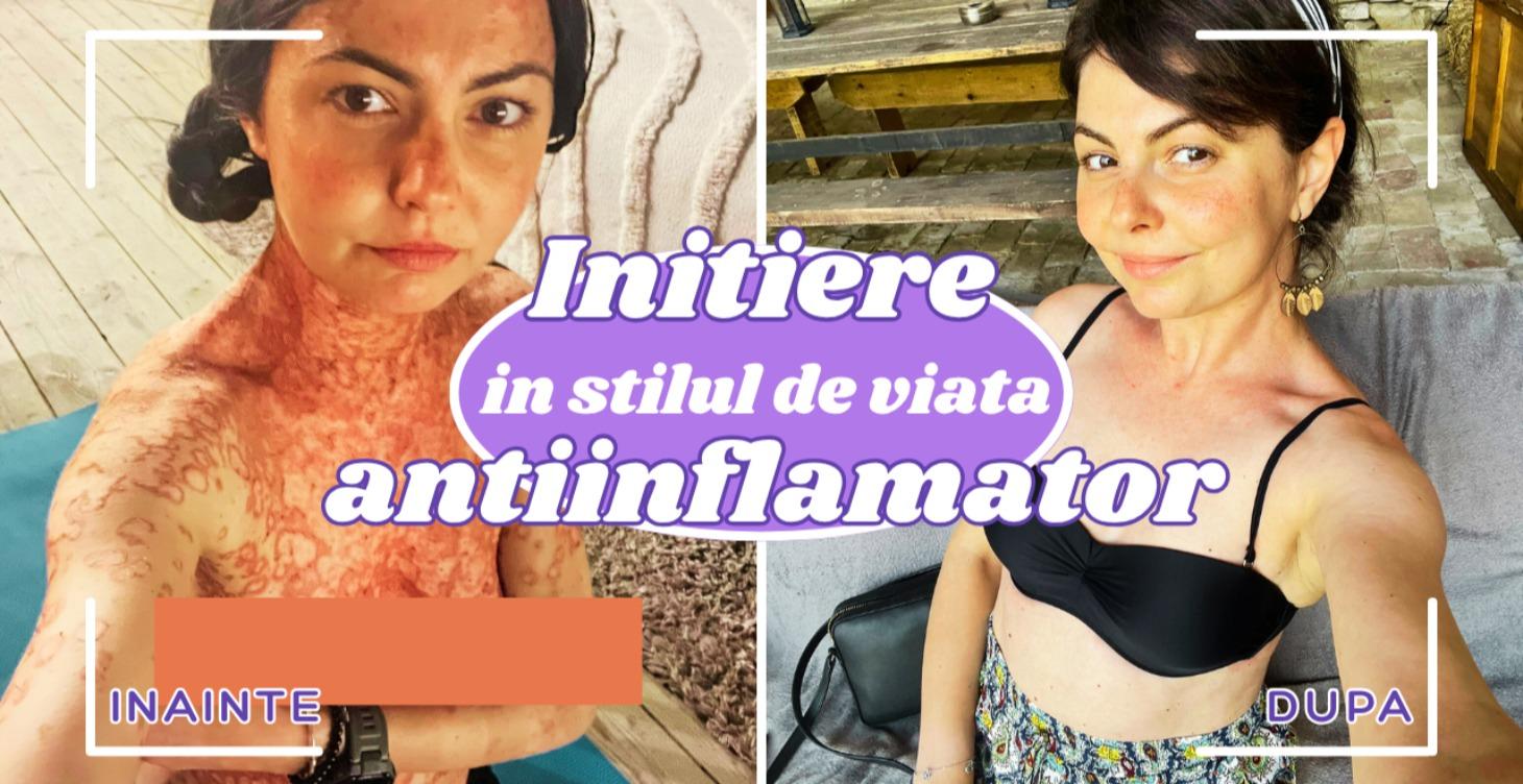 Etapa 0 - initiere in metoda RESET ANTIINFLAMATOR