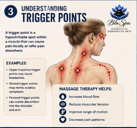 Understanding Trigger Points