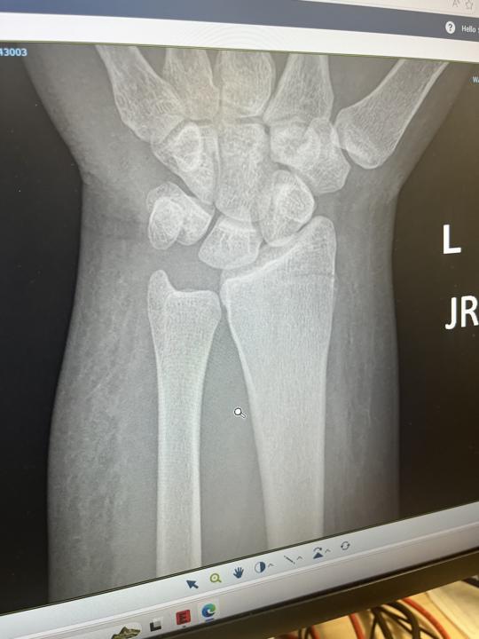 Injury update 