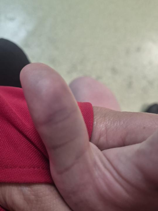 Injury