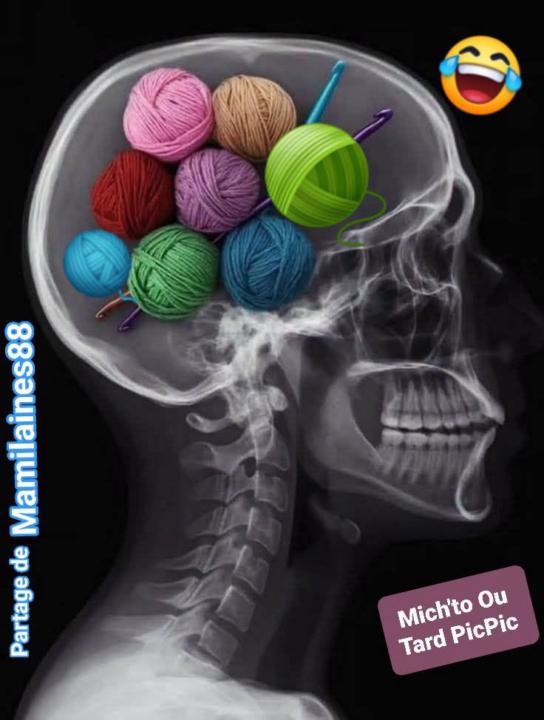 X-rays of a knitting brain