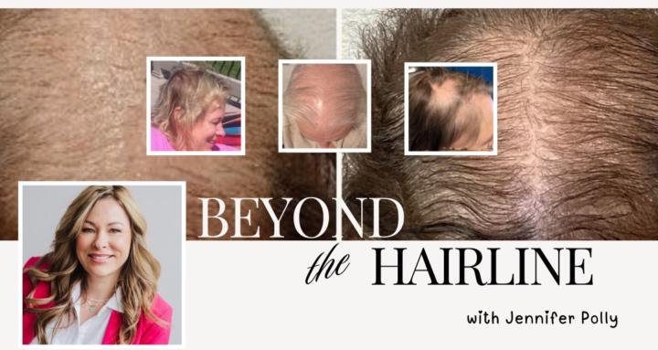 Beyond the Hairline