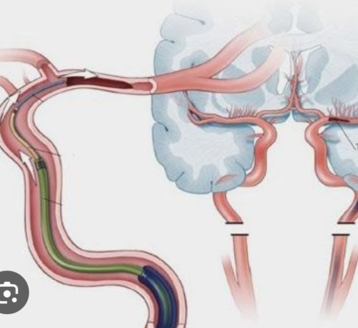 Community Surgical Robotics Research Project...
