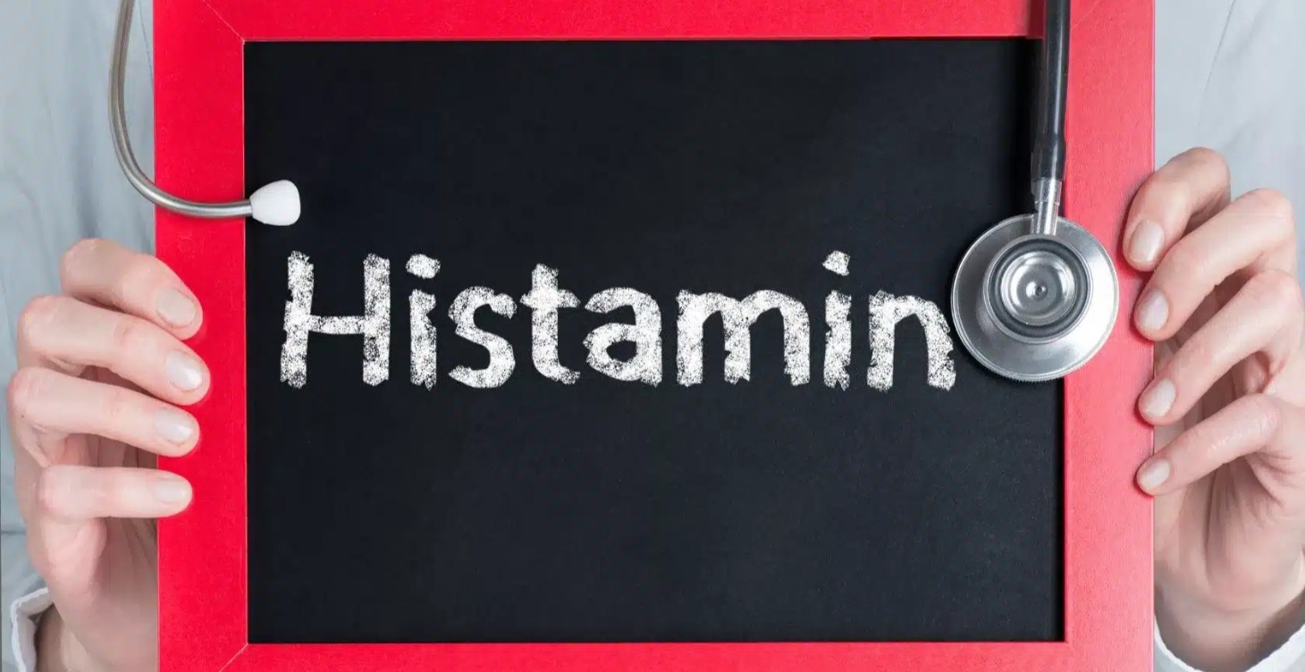 Speciális témakör: Hisztamin intolerancia