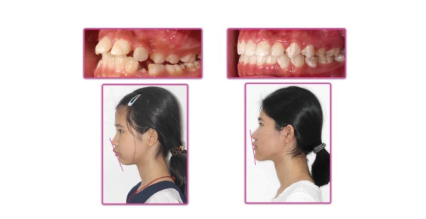 Protocolos Orofaciales