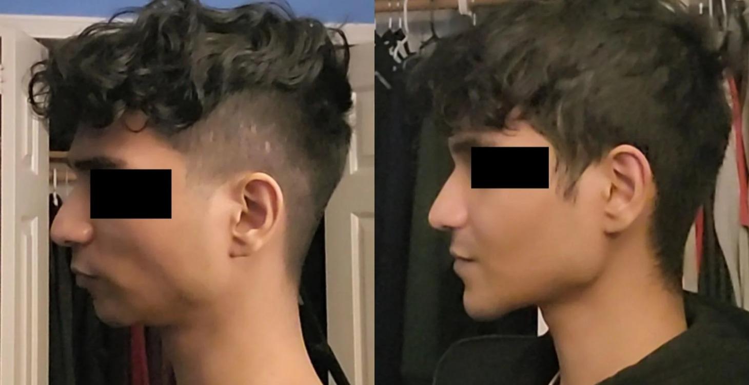 Procedimientos Cosméticos