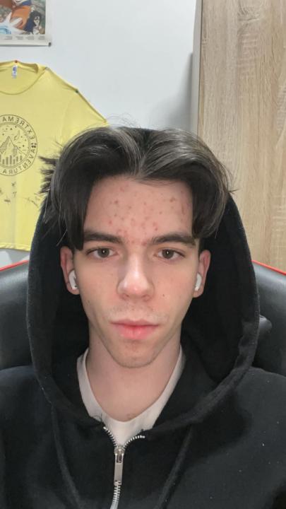 Rating? tengo 18 y mido 183, que puedo hacer para ensanchar mi mandibula?