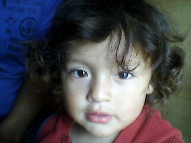 Como me puedo regresar a mí tono de piel de bebé 