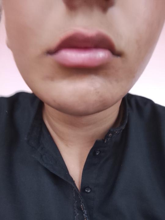 Labios