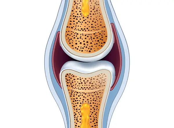 CSCS Daily Practice Question #33