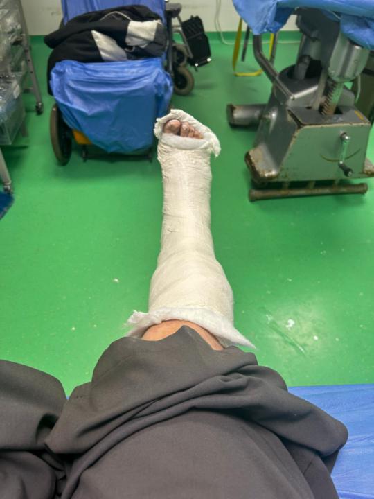 4 HÉT FEKVŐGIPSZ VS. 24 ÓRÁS AUTOMATIZÁLÁS 📉⚖️