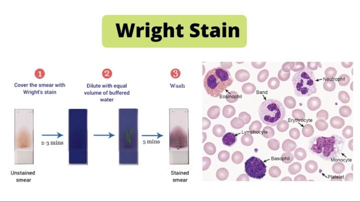 🧫 Stains Revisit Week 🔁 | Wright-Giemsa