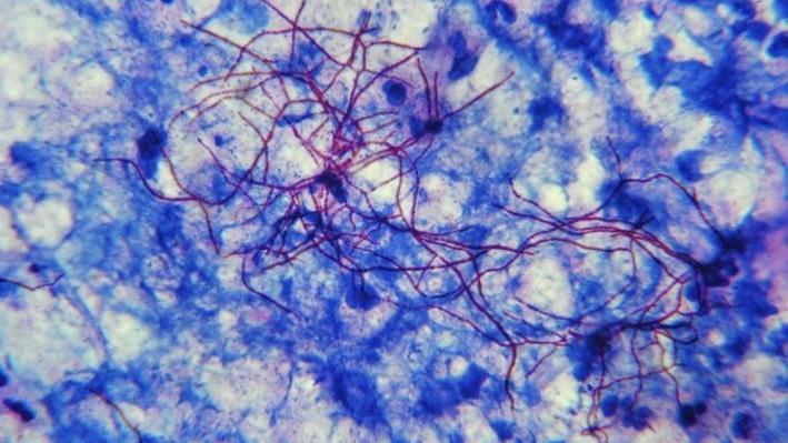 🧫  Micro Stain of the Week with Dede