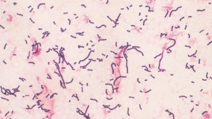 🦠 Organism of the Week: Streptococcus pyogenes