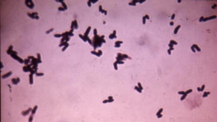 🧫 Organism of the Week 🔬 |  Corynebacterium diphtheriae