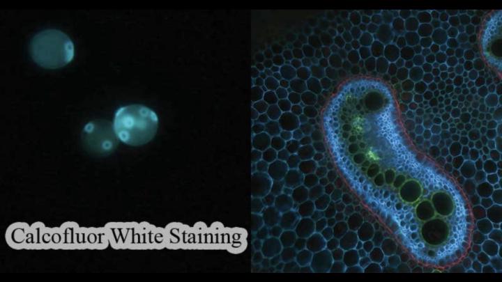 🧫  Micro Stain of the Week with Dede