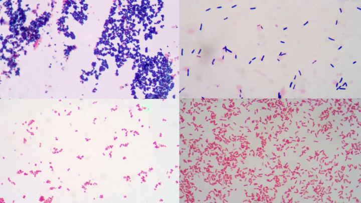 🧫 Gram Stain — Still King?