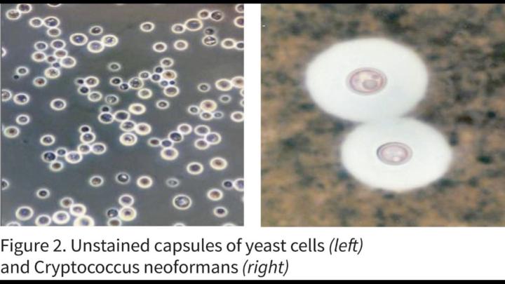 🧫 Stains Revisit Week 🔁 | India Ink