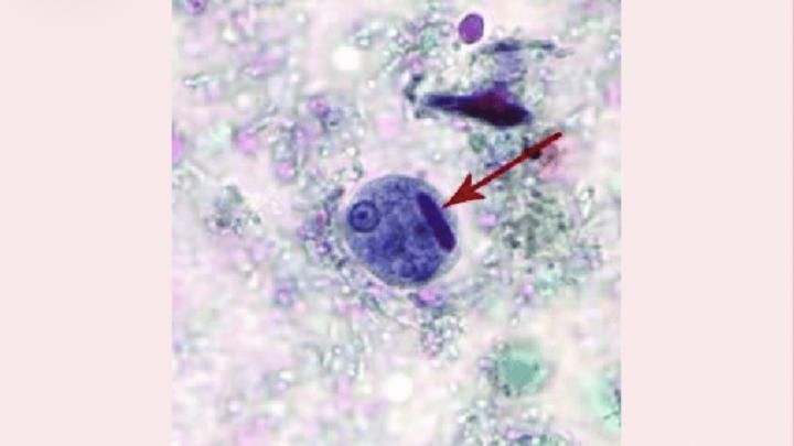 🧫 Micro Stain of the Week with Dede