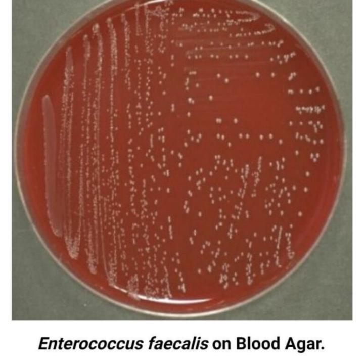 🦠 Organism of the Week: Enterococcus faecalis