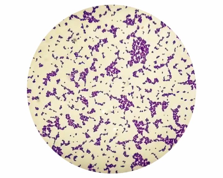 🦠 Organism of the Week: Staphylococcus aureus
