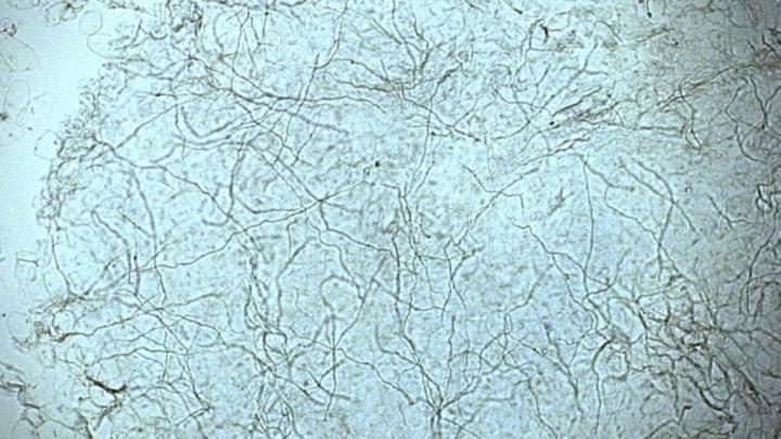 🧫 Stains Revisit Week 🔁 | Fungal Detection