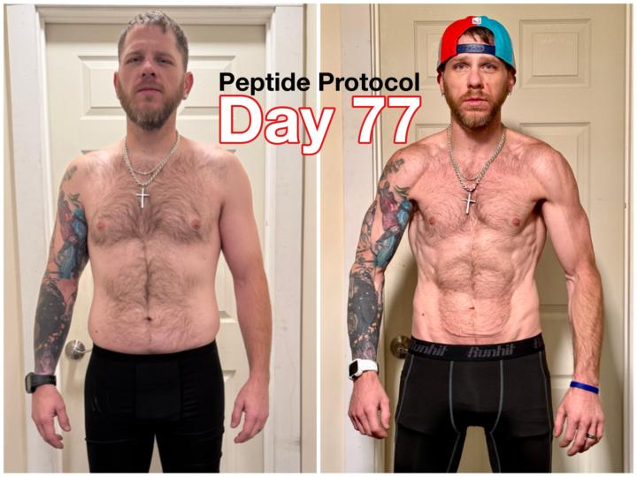 💪🏻🏋🏼‍♂️Day 77 Retatrutide photo update 📸