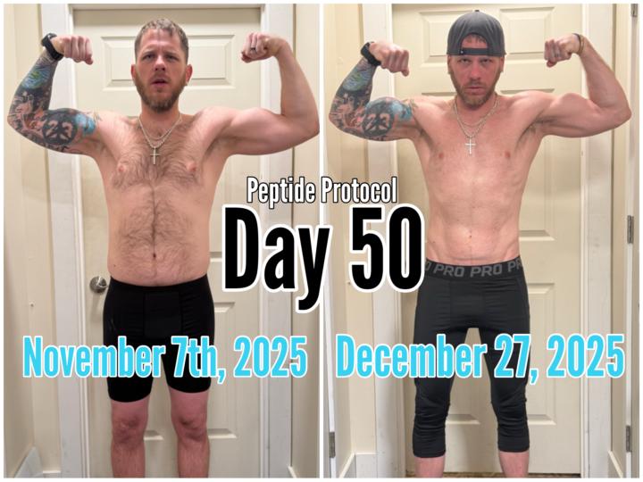 🧬💉 Day 50 Photo Update 💉🧬