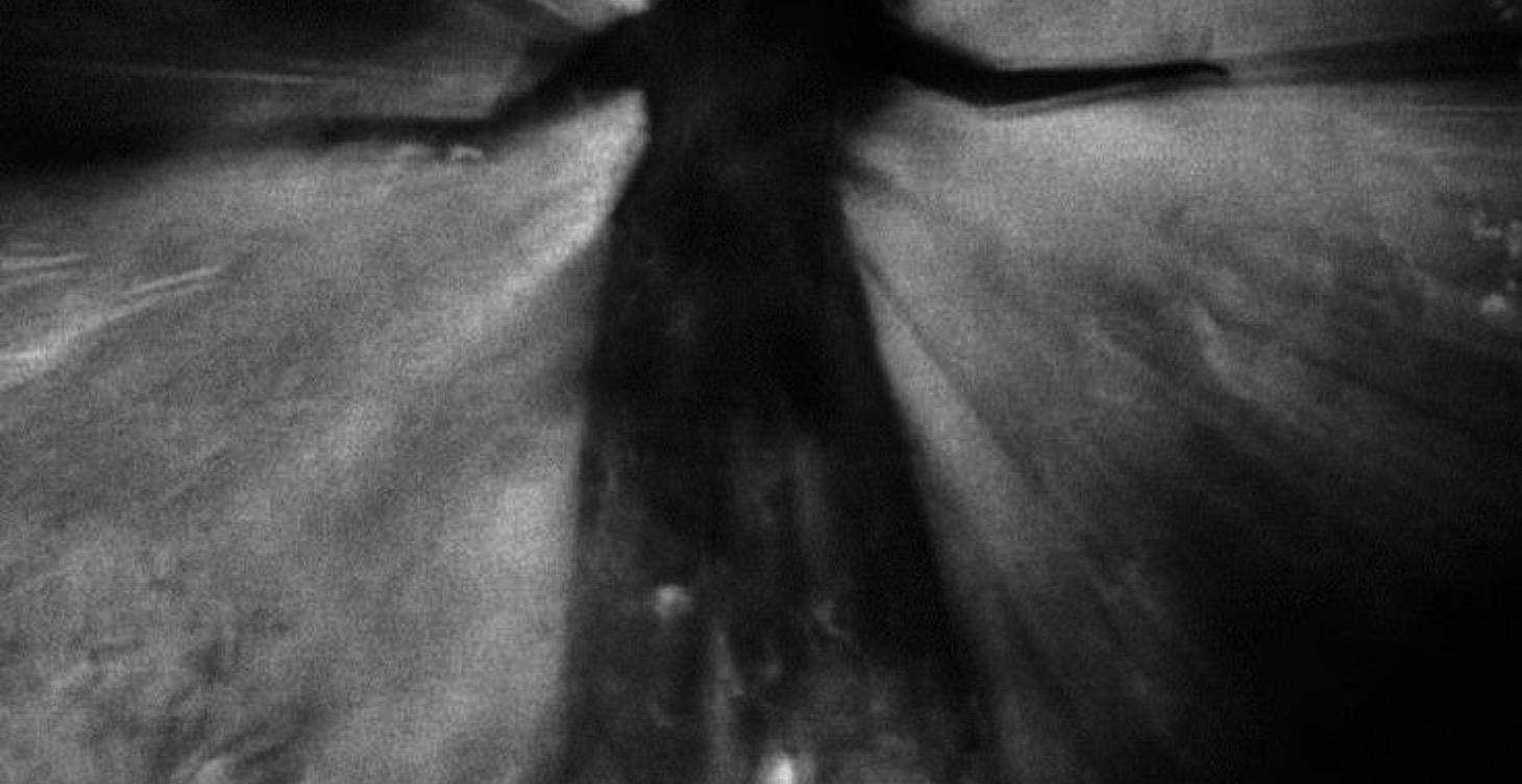 Psychic attack/ mental health How to differentiate