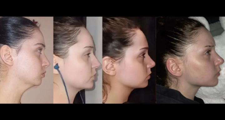 Katarina's community