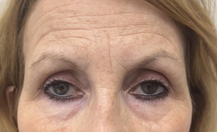 Mapping advice ❤️