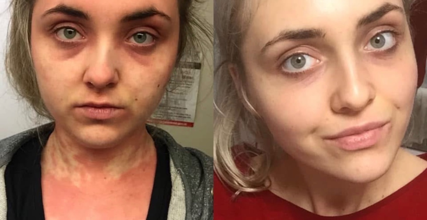 ❤️ Eczema and Skin Conditions🪽