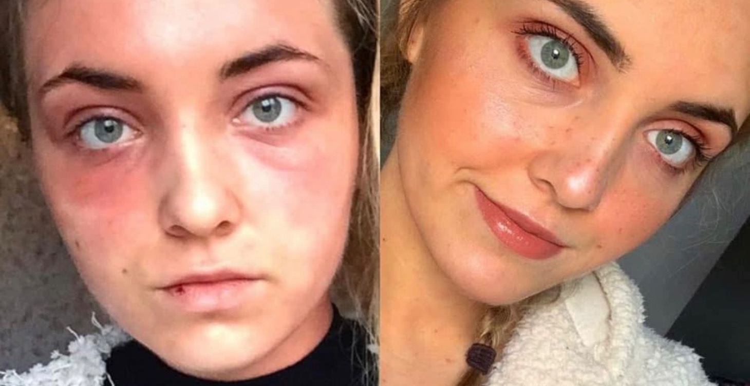 Success Stories 🏆