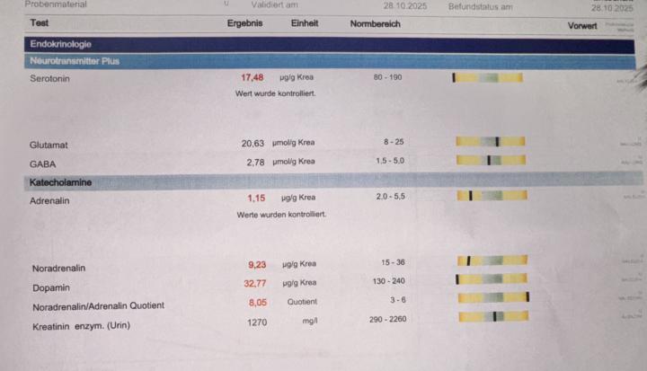 Ergebnis meines Neurostress Tests