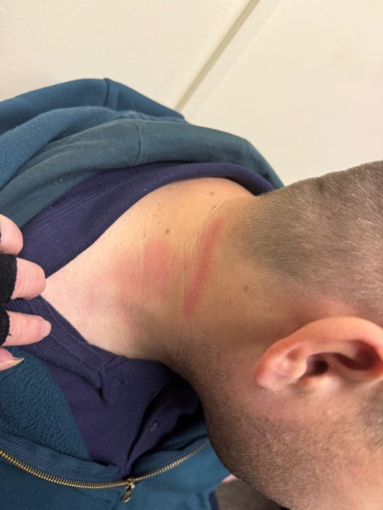 Scratch appearing as it was happening 