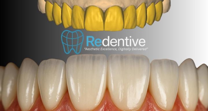 Redentive Academy: Exocad Hub