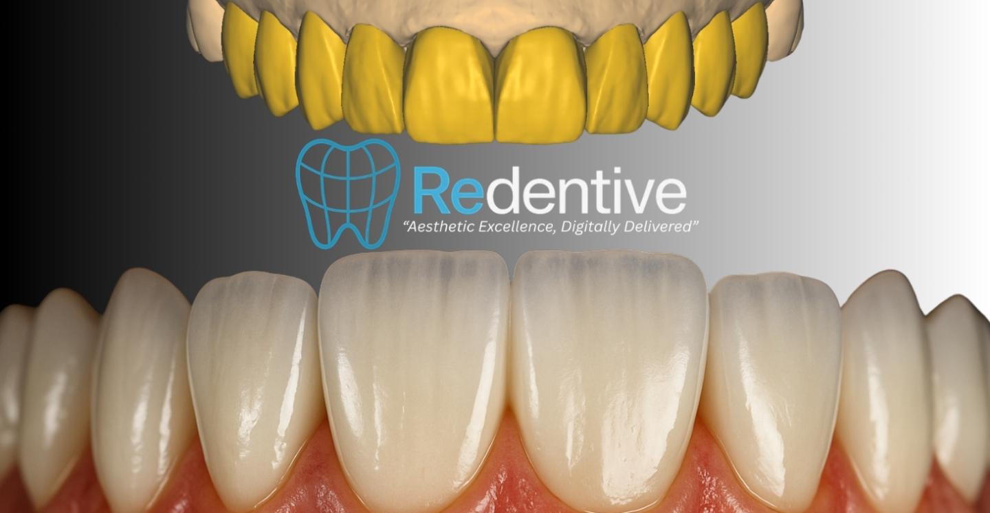 Redentive Academy: Exocad Hub