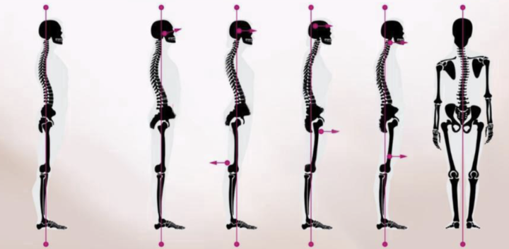 先看一眼，你的骨盆在哪裡？