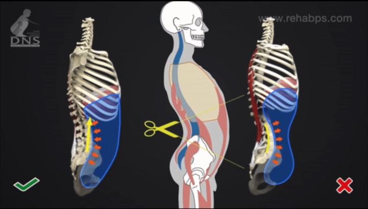 🩻 Rib Cage vs Pelvis Relationship – Why It Matters for Hitters 🩻