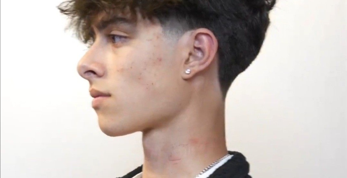 Facial Structure (Beginners)