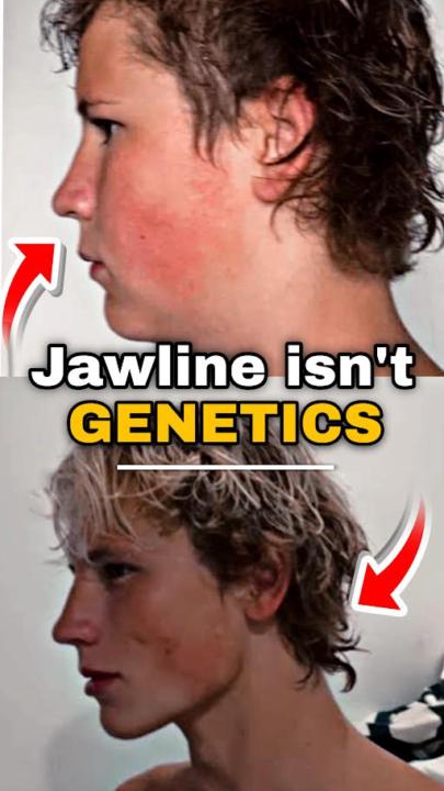 🦴 How To Sharpen Your Jaw (Full Guide)