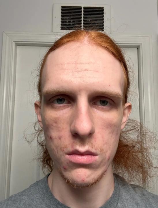 BEST Ascend or Die Transformation’s OAT ♾️ — (CASE STUDY) 📚 