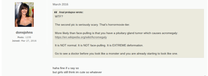 Does this guy have acromegaly?