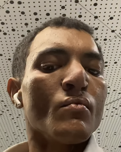What happened to Jerion's nose?