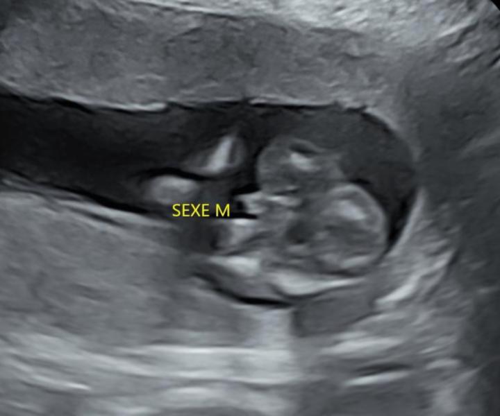 Petit post pour vous annoncer une bonne nouvelle