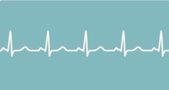 EKG Refresher