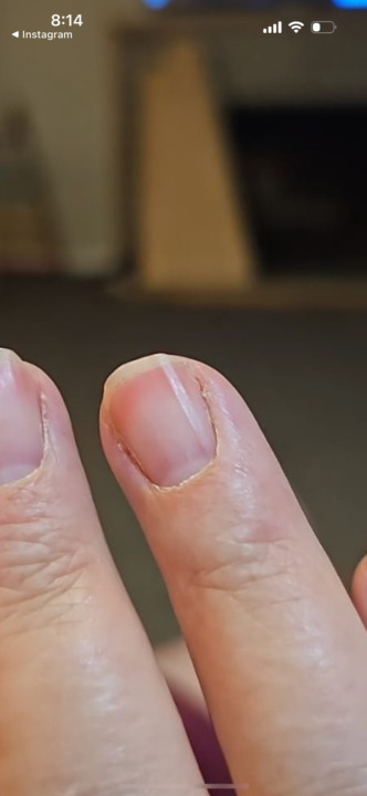 Nails with splitting 