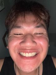 Toan Nguyen